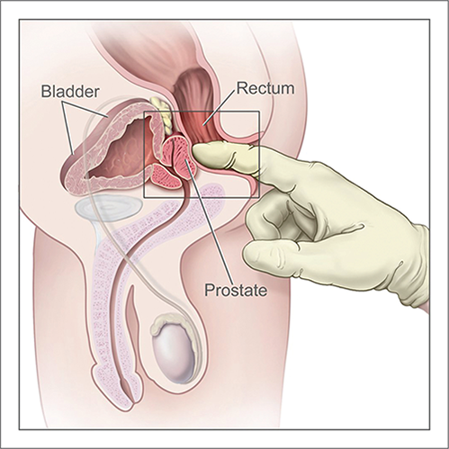 How to use a dildo for men; medical graphic showing the male genitals, cross sectioned, with a gloved finger reaching through the rectum and touching the prostate gland.