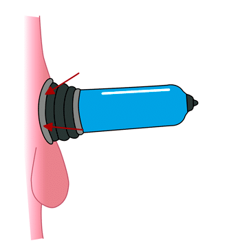 How to Use Penis Pumps