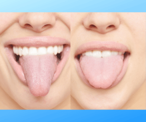 Why learn to eat pussy? Photo of people sticking out tongues